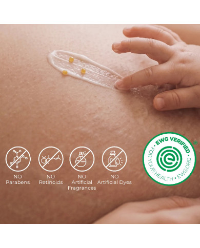 MOMCOZY STANGRINAMASIS KŪNO KREMAS NUO STRIJŲ SU KOLAGENU, 30 G